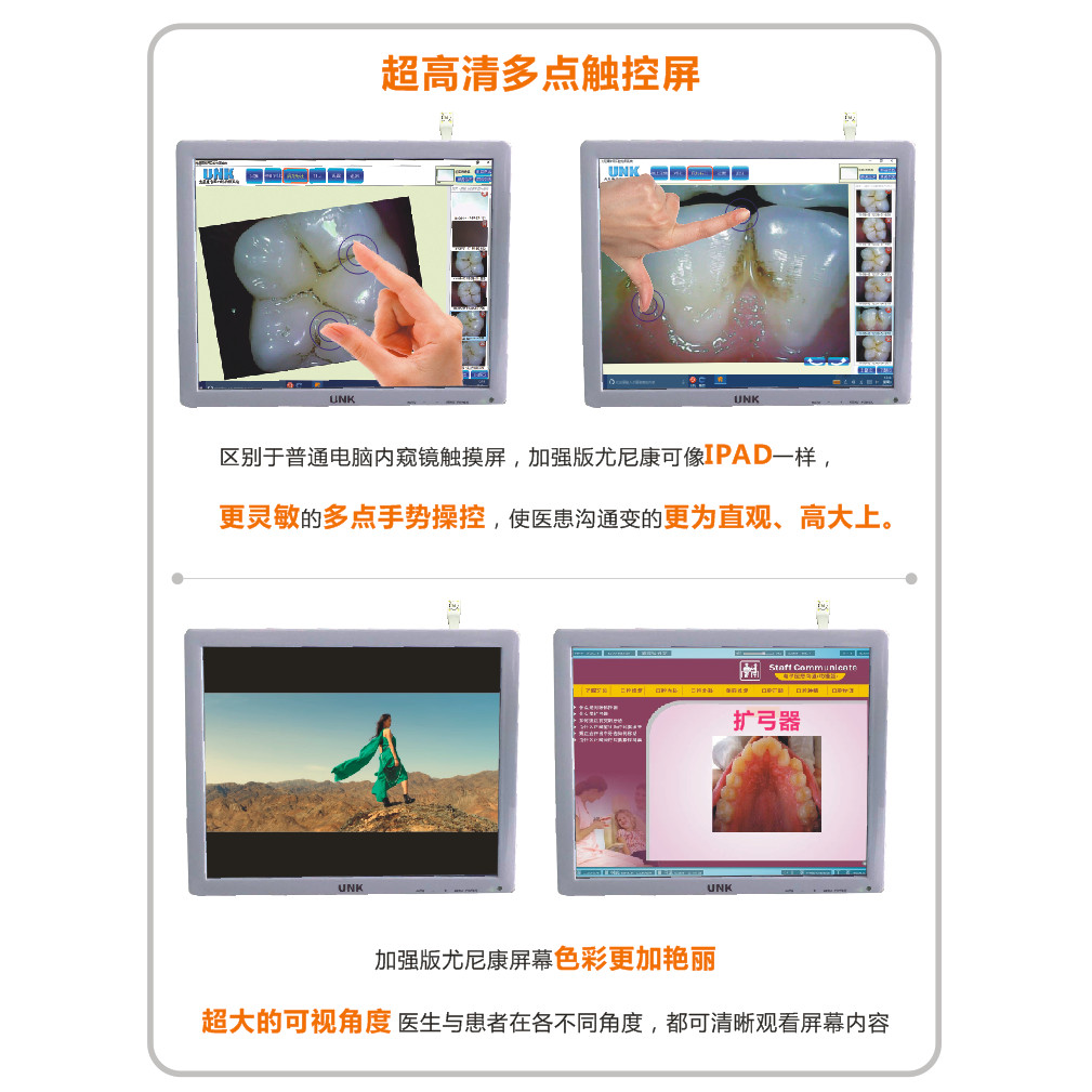 ใหม่ Luoyang Yonikon Endoscope UNK Professional Oral Collection System Yonikon Endoscope All-in-One 