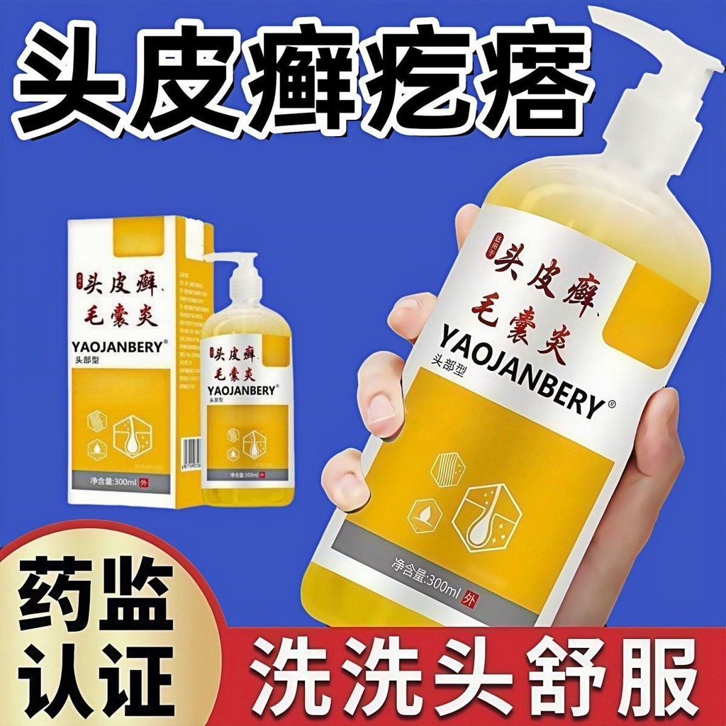 Hot Sale#Scalp Ringworm Pimple Shampoo Itchy Scalp Pimples Pustules Seborrheic Dermatitis Skin Disin