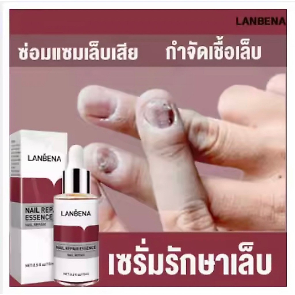 ของแท้ 100% LANBENA เซรั่มบำรุงเล็บ แก้เชื้อราที่เล็บ ไม่ทำร้ายเล็บดี ห่างกับปัญหาเล็บ ซ่อมแซมเล็บ ขนาด15ml