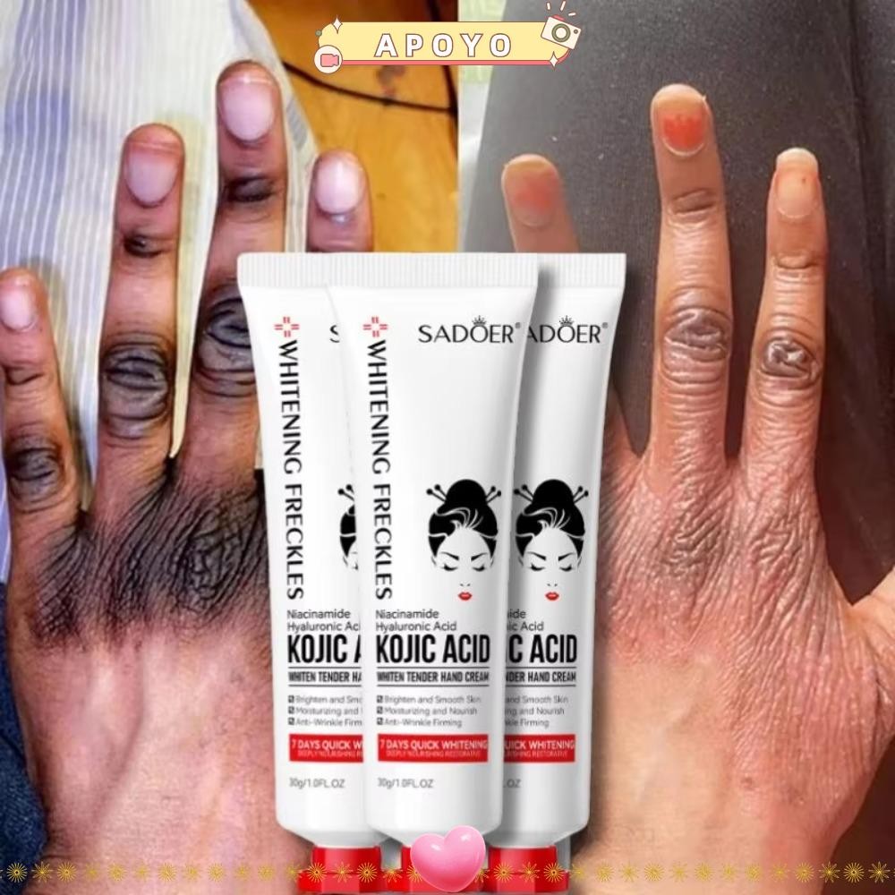 APOYO Kojic Acid Fade ครีมทามือหมองคล้ํา, กําจัดริ้วรอย Anti-crack Kojic Acid Whiten Tenderhand Crea