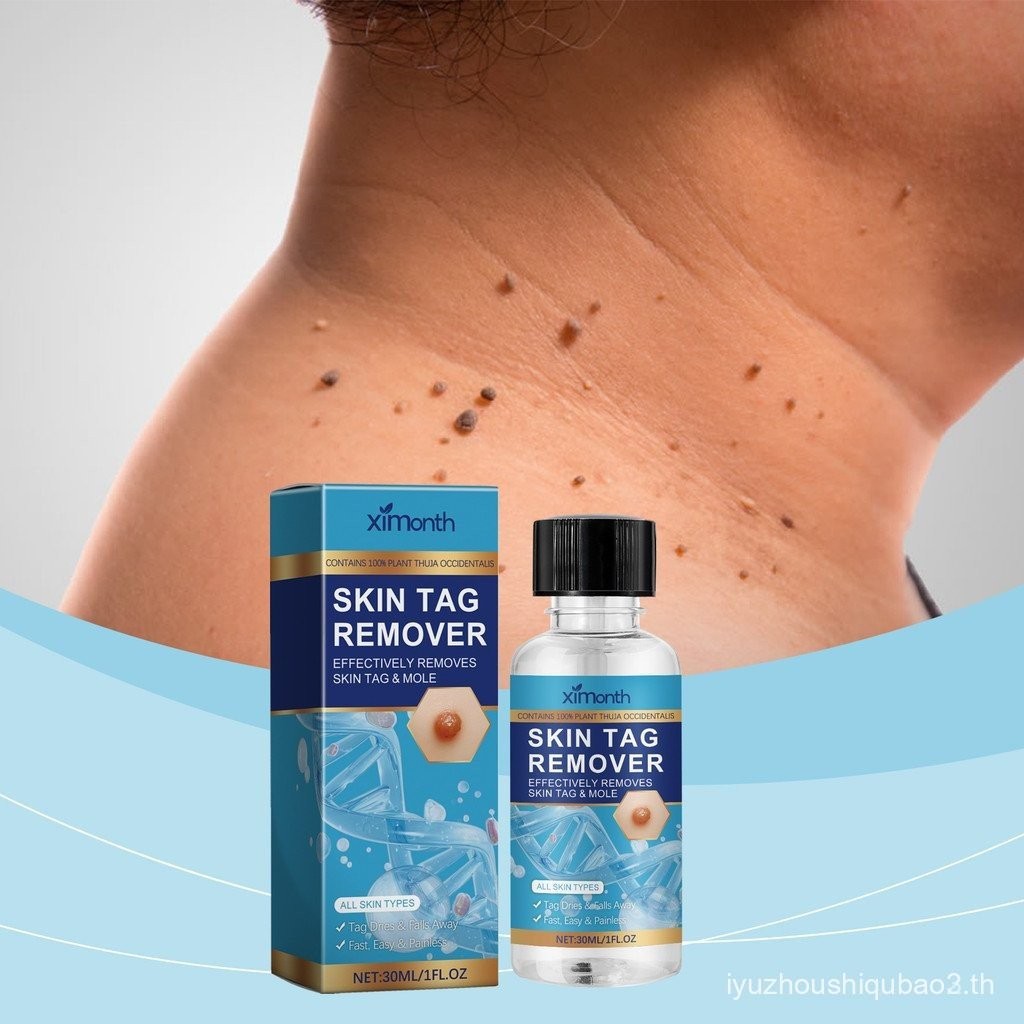 Ximonth Ximonth Ximonth Hand Foot Skin Euro Dark Mole Cleansing Repair Smooth Skin Label Care Lotion