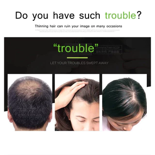 [🇹🇭⚡12hจัดส่ง] 4PCS Toppik Hair Fibers สเปรย์หนาผม Building Fibers Loss ผลิตภัณฑ์ทันทีวิกผม Regrowth ผง