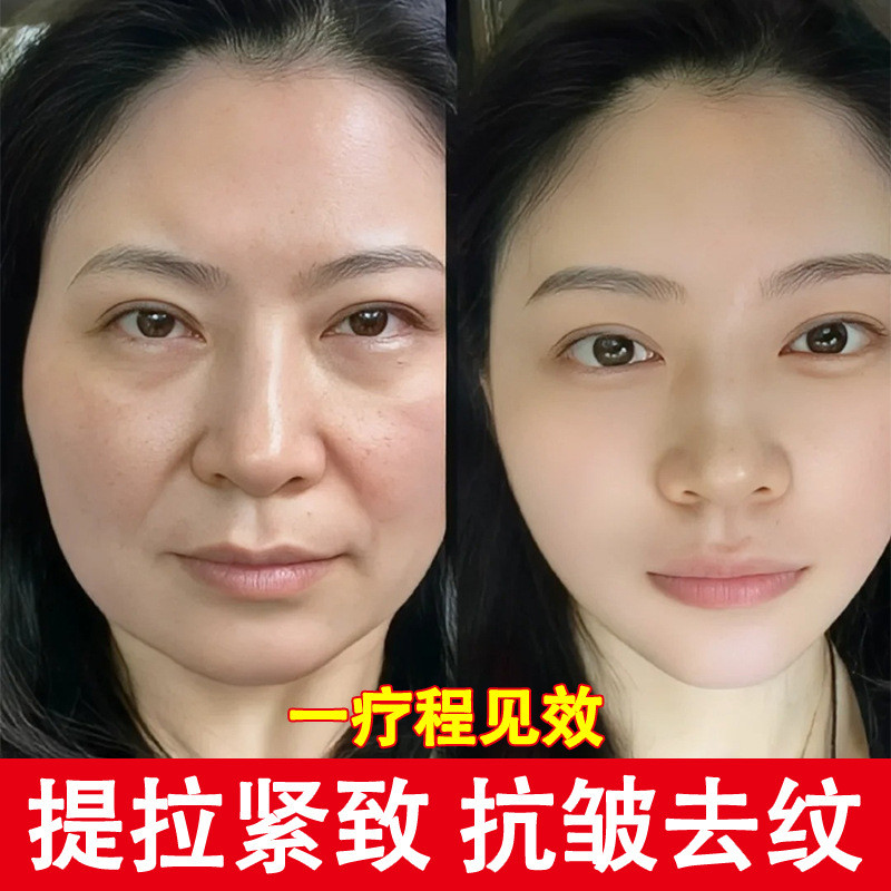 คอลลาเจนสต็อก Liquid Lifting Firming Filling Depression สาม Categories Reorganize Removing Head Line