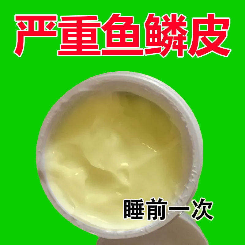 New Product#[24Hourly Delivery]Fish Scale Snake Skin Nemesis Leg Dryness and Peeling Repair Cream Fi