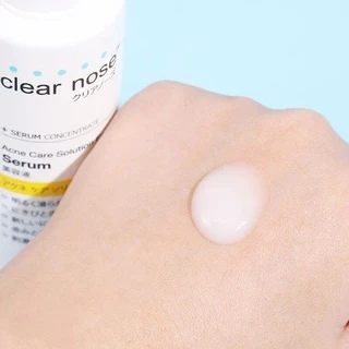 CLEAR NOSE Acne Care Solution เซรั่มบํารุงผิวหน้า 100ML เซรั่มบํารุงผิว เซรั่มบํารุงผิว