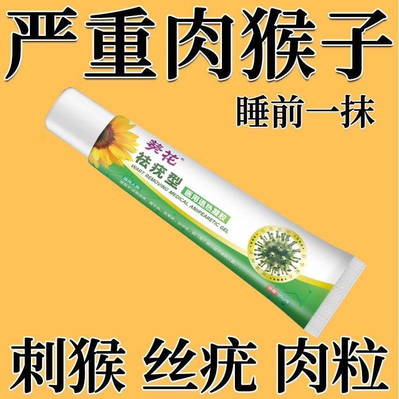 Wart Removal ธรรมดา Wart แบน Wart Filamental Wart Metatarsal Wart Removal Off Sunflower Removal Wart