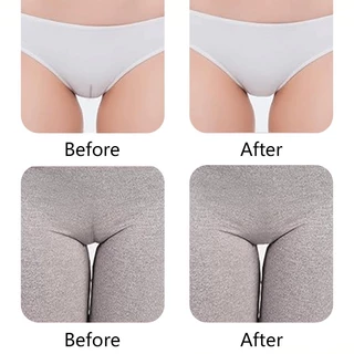🧡Basic swimsuit💛 แผ่นซิลิโคน บิกินี่ ใหม่รูปตัว Y Private silicone patch ปกปิดรอยนูน สำหรับผู้หญิง S-L