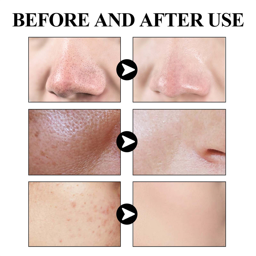 COD Mud Mask มาส์กโคลนสติ๊กแก้ผิวมัน สิวหัวดำ รูปที่ 6