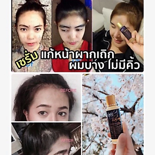 📣Witch Hair เซรั่มปลูกผม คิ้ว หนวด ขวดแรกเห็นผล💯% ขนาด 60ml.