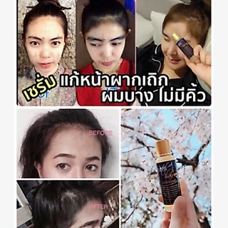 📣Witch Hair เซรั่มปลูกผม คิ้ว หนวด ขวดแรกเห็นผล💯% ขนาด 60ml.