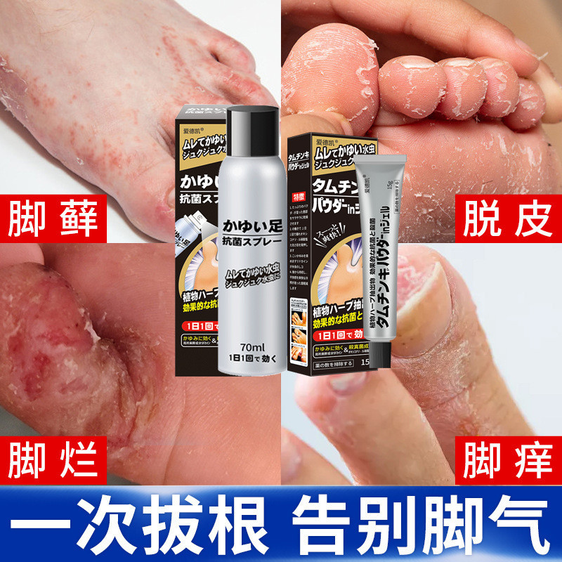 Spot Goods#Athlete's Foot Odor Cream Athlete's Foot Spray Foot Odor Spray Itchy Peeling Foot Cream A