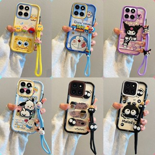 เคส HONOR X7D เคสโทรศัพท์ซิลิโคนอ่อนนุ่มป้องกันการตกลายการ์ต…