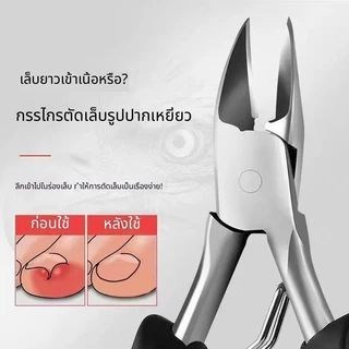 Xintai ที่ตัดเล็บ/ที่ตัดเล็บสำหรับผู้สูงอายุที่มีเล็บหนาและแข็งโดยเฉพาะ/กรรไกรตัดเล็บแบบมีร่องเอียง