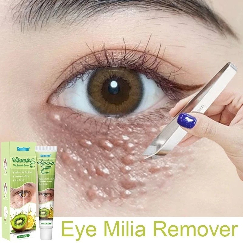 20g ไขมัน Granule ครีมวิตามินอี Krim Milia Seed Remover Eye ครีมไขมัน Granule Syringoma Milia Remover จาระบีธัญพืช Eye Health Care