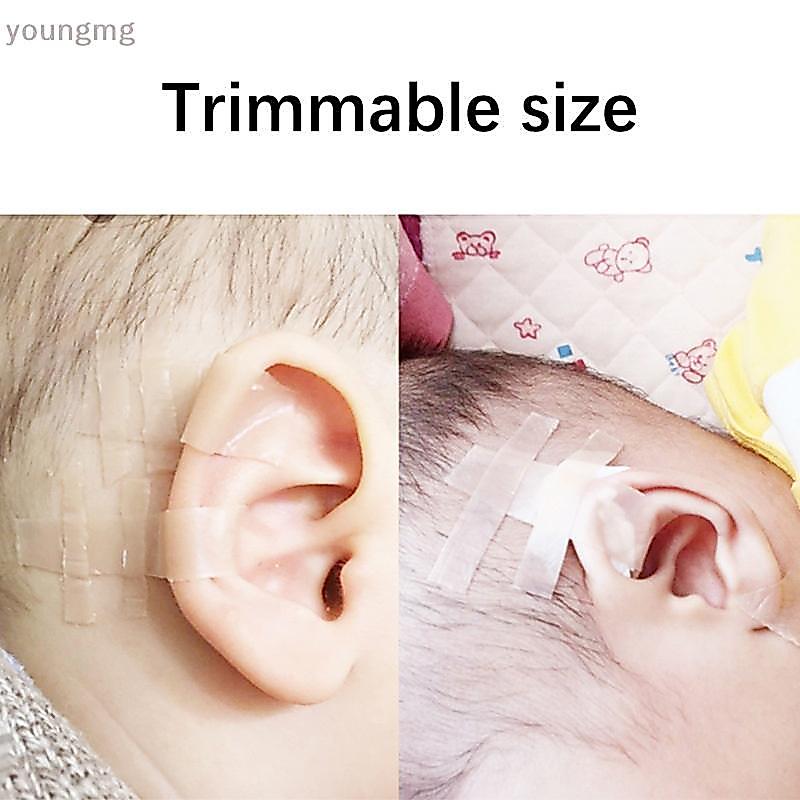 [YG] 1 ม้วน Baby Ear Corrector ทารกยื่นหูแก้ไขซิลิโคนเด็กหูความงาม Correctors Patch Stier Ear Care TH