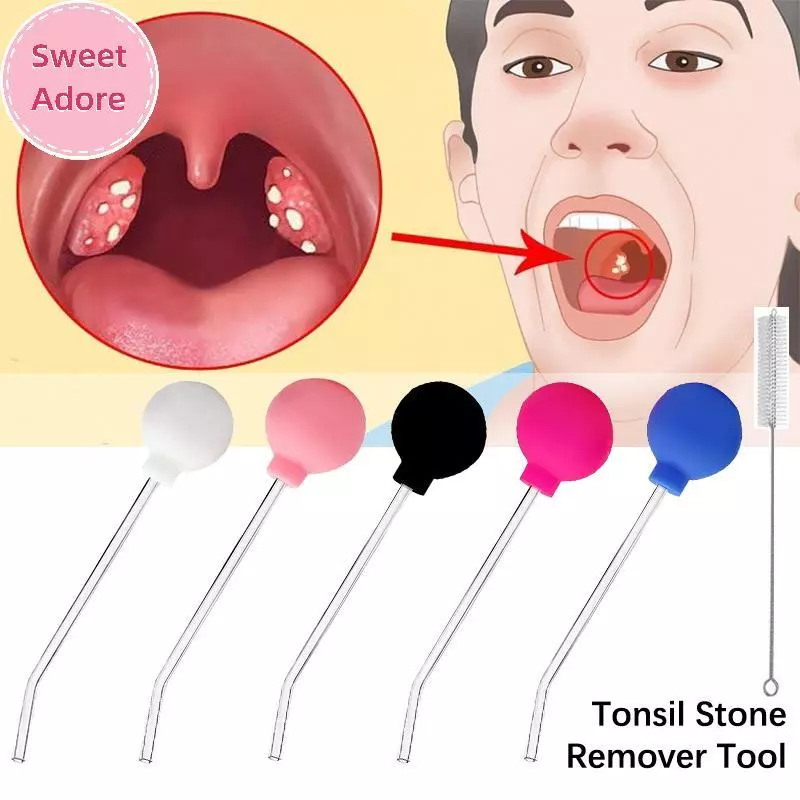 SweetAdore Tonsil Stone Remover เครื่องมือคู่มือสไตล์ Remover ปากทําความสะอาดเครื่องมือ Ear Wax Tonsil หินดูด Ball Manual สไตล์ทําความสะอาด TH