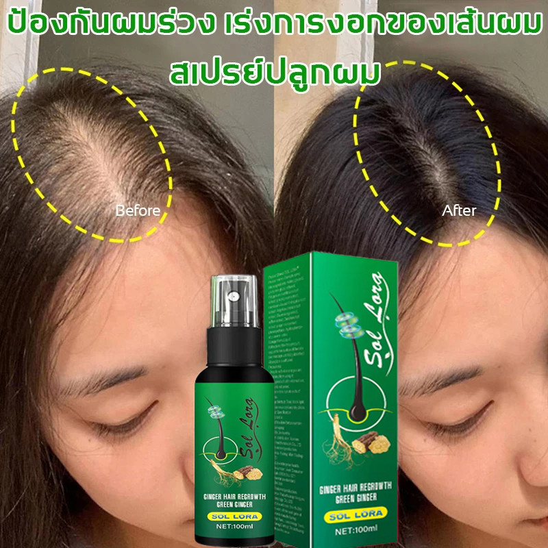 SOL LONG นีโอแฮร์ของแท้ 100ML สเปรย์ปลูกผม น้ำยาปลูกผม ปลูกผม เซรั่มปลูกผม ป้องกันผมร่วง Hair Growth