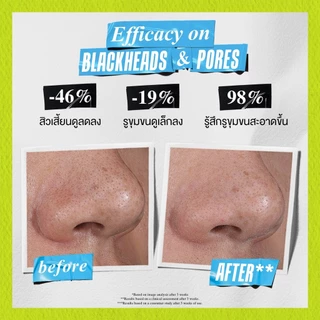 KIEHL'S RARE EARTH DEEP PORE CLEANSING MASQUE 125ML มาส์กทำความสะอาดหน้า มาส์กลดสิว ทำความสะอาดรูขุมขนล้ำลึก
