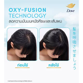 Dove Advance Hair Series Shampoo 480ml โดฟ แชมพูใสไมเซล่า (Moisture + Oil/Moisture + Oxygen)