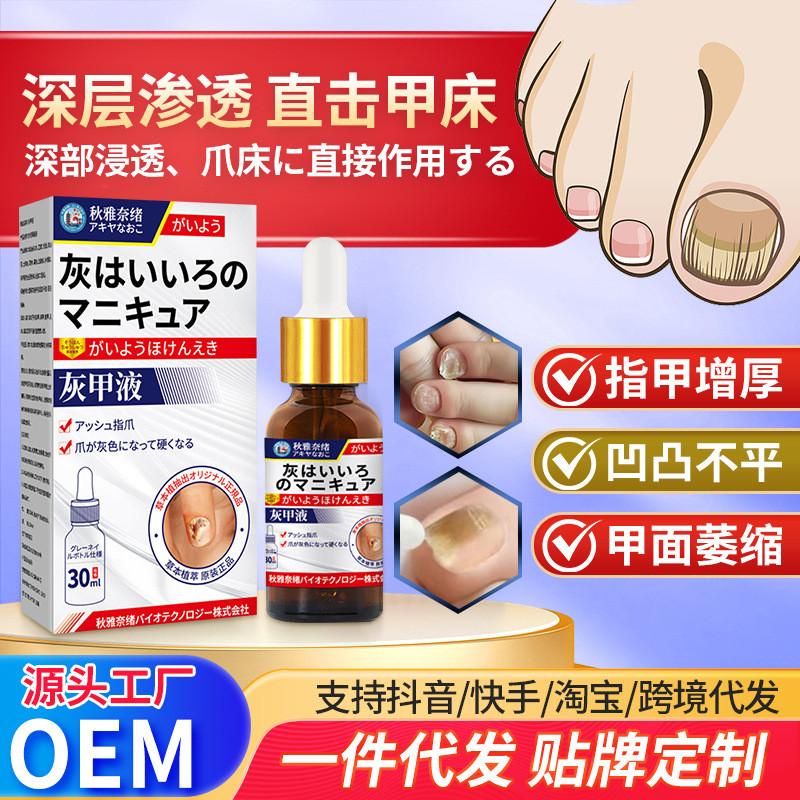 Qi Yanao Nao Onychomycosis Liquid External Health Care Liquid Hand Foot Nail Thickening Brightening 