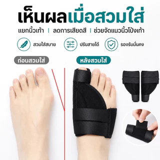 COD แก้ไขนิ้วเท้า ซิลิโคนคั่นนิ้วโป้ง+ผ้ารัดสำหรับหัวแม่เท้าเอียง แก้ไขนิ้วเท้าแข็ง
