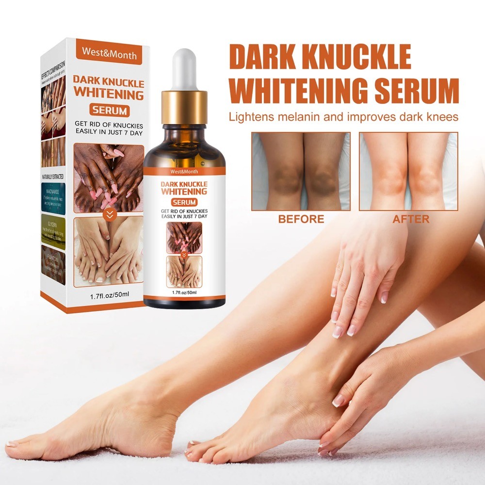 Dark Knuckles Lightening Hand Knuckles ข้อศอกเข่า Lighten Oil Beauty Care 50ml