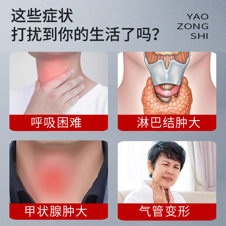 Mo Master Thyroid Patch Big Neck Object Feeling Cream Patch Swollen คอหนา Spellent Knots ที่ละเอียดอ