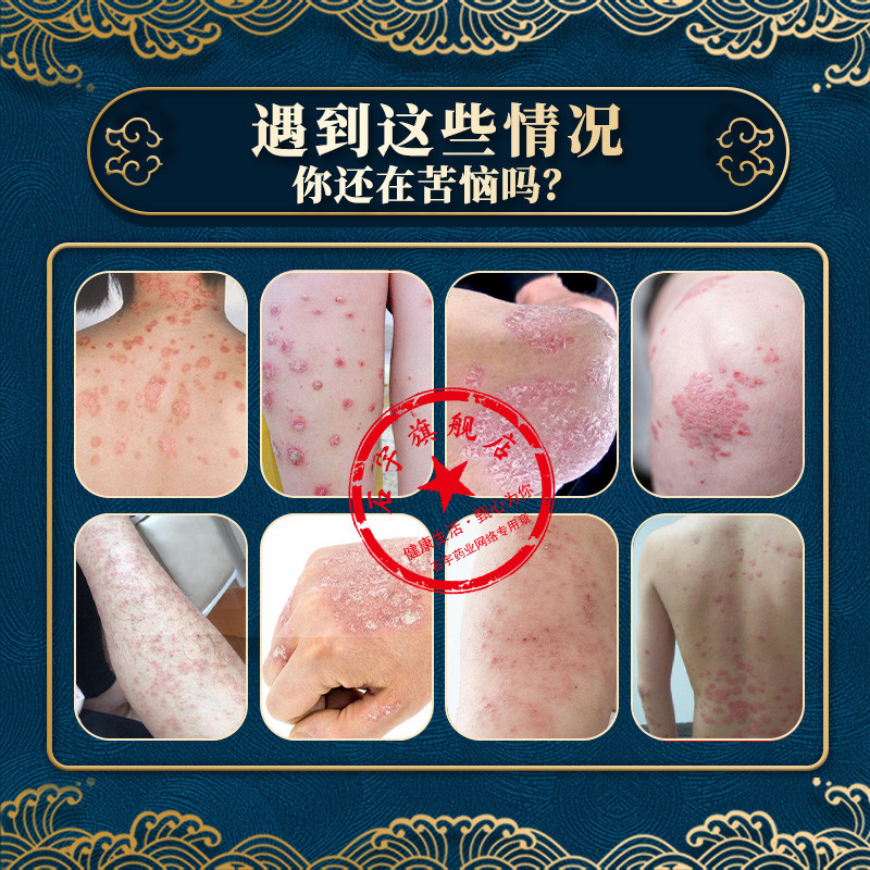 Shiyu Jinxian Light 40ml สเปรย์ + 20g เจลชุด Fat Overflow Hair Follicle Official Flagship Store One 