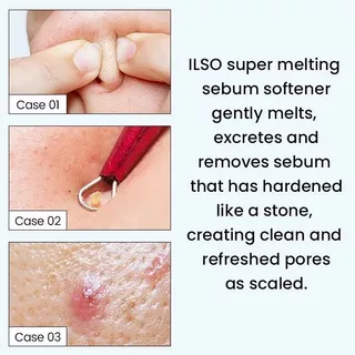 ilso Super Melting Sebum Softener 150 ml + DEEP CLEAN MASTER