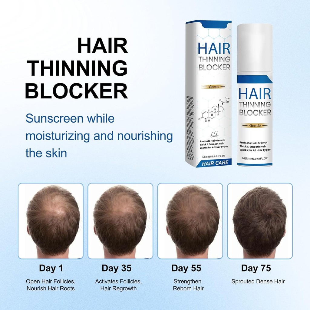 2pcs Genthair DHT สําหรับผู้ชาย,Genthair Hair Growth Roller, Genthair DHT Roll On for Men, Hair Grow