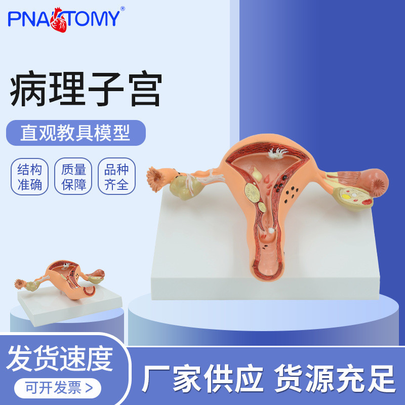 Spot Goods#Human Model Female Reproductive Uterus Vagina Ovary Uterus Teaching Mold Pathological Cha