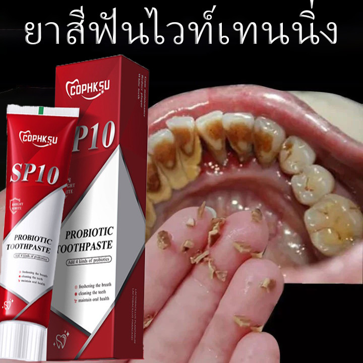 ยาสีฟัน SP-10 ลดฟันเหลือง ฟันขาว ขจัดกลิ่นปาก ป้องกันฟัน เหมาะกับทุกคนในครอบครัว ฟอกสีฟัยาสีฟันโปรไบโอติกยาสีฟันฟันขาว