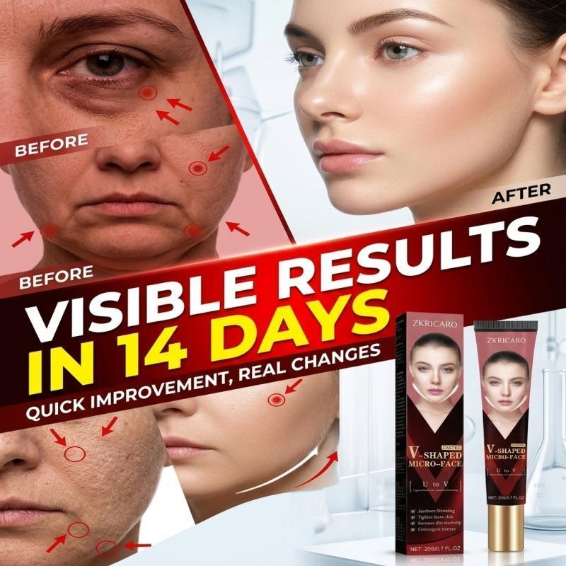 U to V Face Shaping Cream สําหรับทุกสภาพผิว ลดริ้วรอยหน้าผาก ดูแลผิวหน้า ครีมกระชับและคอนทัวร์ 20 g