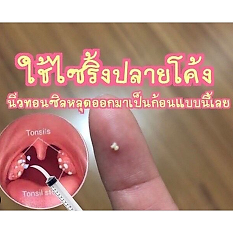 ไซริ้งค์ปลายโค้ง2ชิ้น กำจัดนิ่วทอนซิล ไซริ้งฉีดฟันคุด 🔥ถูกที่สุด🔥 พร้อมส่งจากไทย