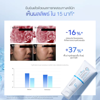 [New] FACERINNA 5% B5 Intensive Barrier Balm Cream 30ml | บางเบาซึมไว ปลอบประโลมผิว ฟื้นฟูเกราะผิว เติมชุ่มชื้นลึก