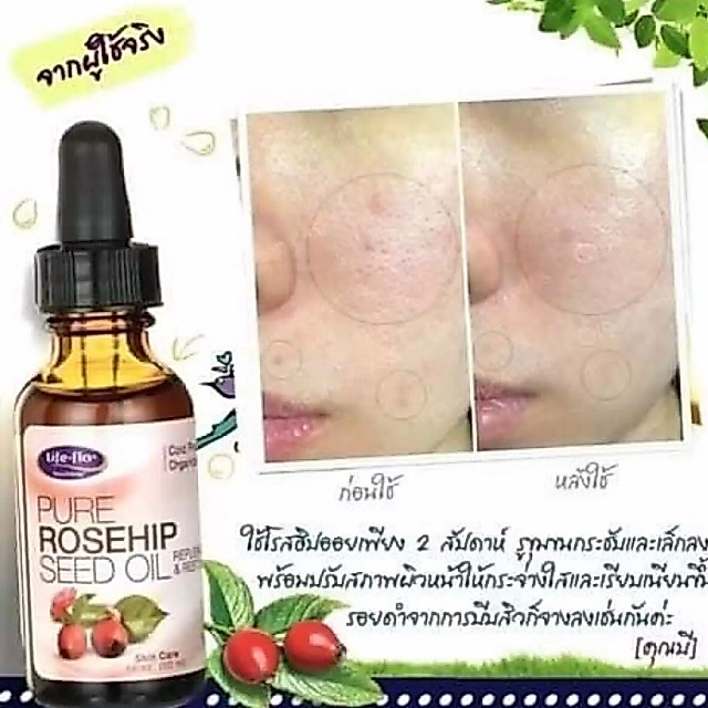 Life Flo Health, Pure Rosehip Seed Oil, Skin Care, 1 oz (30 ml)