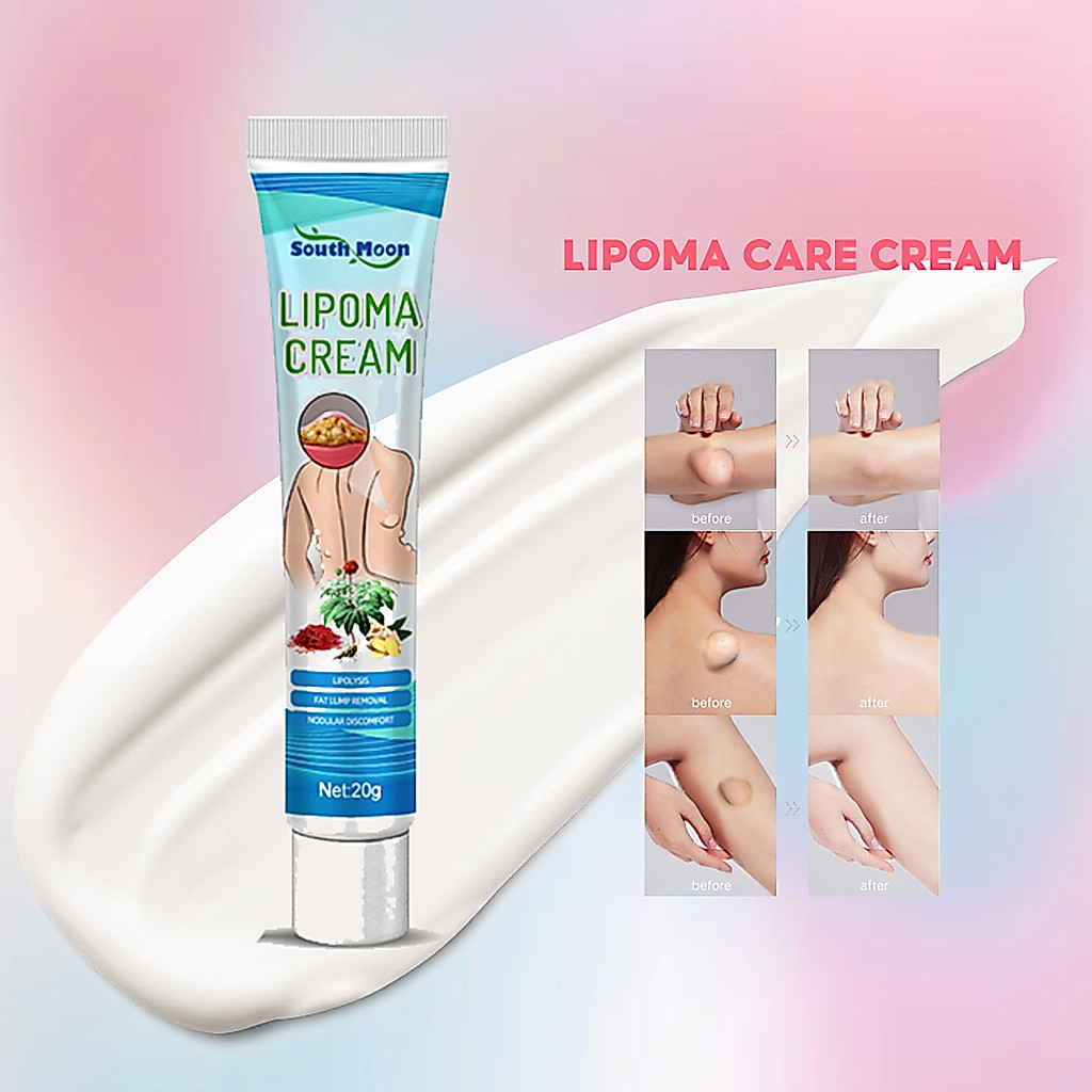 ครีมกำจัด lipatoma ครีมบำรุง Liposoma ก้อนไขมันแข็ง เนื้องอกไขมัน สมุนไพรกำจัด ก้อนเนื้อใต้ผิวหนัง ก้อนซีสต์