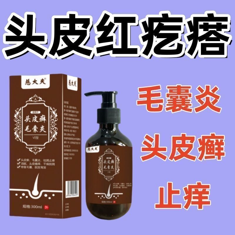 Hot Sale#Tinea Capitis Scalp Ringworm Pimples]Shampoo for Itchy Scalp, Pimples, Pustules, Seborrheic