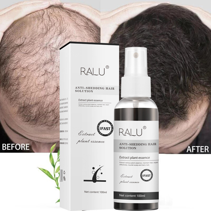 R RALU Anti-Hair Loss Anti-Hair Lossการผลิตผมร่วง Hairline Hair Growth บํารุงรากผม 25.10.3