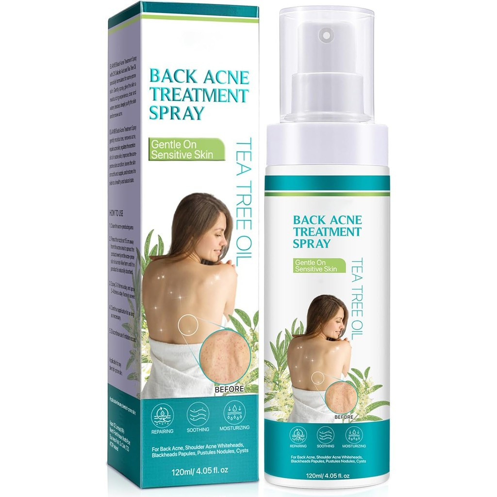 Back Acne Treatment, Back & Body Acne Treatment For Reduce Back Spots & Acne & Lightening Ance Marks