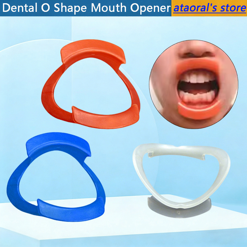 3PCS Mouth Opener Dental Lab O-shape Cheek Retractor Expanders Lip Mouth Opener เครื่องมือทันตกรรม