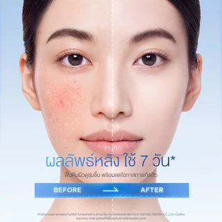 [New] FACERINNA 5% B5 Intensive Barrier Balm Cream 30ml | บางเบาซึมไว ปลอบประโลมผิว ฟื้นฟูเกราะผิว เติมชุ่มชื้นลึก