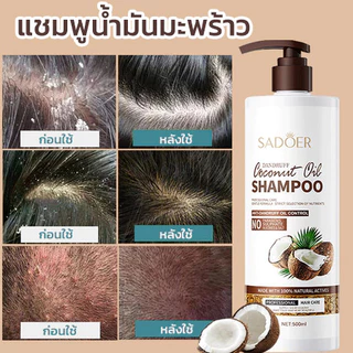 （ซื้อ 1 แถม 1）แชมพูน้ำมันมะพร้าว แชมพูสูตรอ่อนโยน ลดรังแค ควบคุมความมัน บำรุงรากผมให้แข็งแรง ผมนุ่มฟู500ml