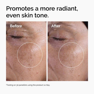 The Ordinary Glycolic Acid 7% Exfoliating Toner ขนาด 240mL โทนเนอร์ผลัดเซลล์ผิว ช่วยให้สีผิวแลดูสม่ำเสมอ