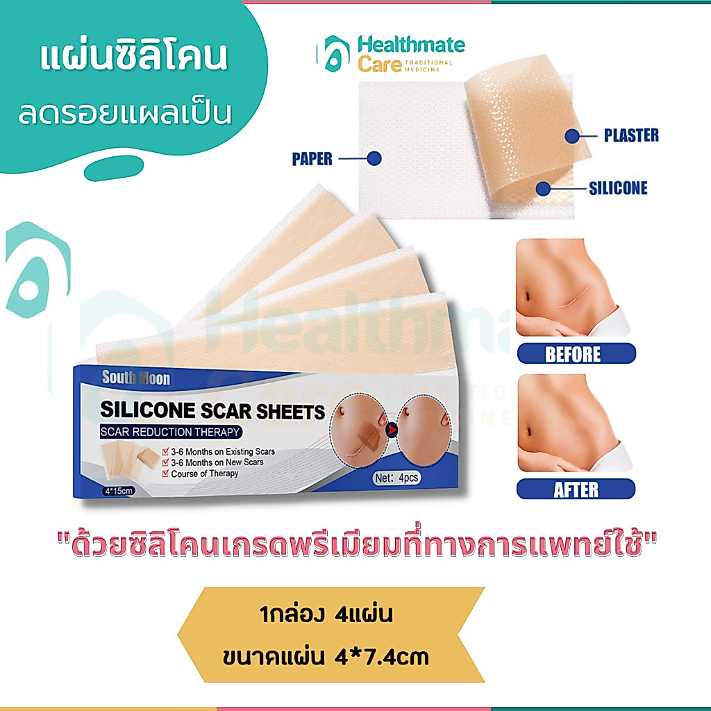 แผ่นซิลิโคนแปะรอยแผลเป็น เกรดทางการแพทย์ใช้ (1กล่อง4แผ่น ขนาด4*7.4cm) ลดรอยแผลนูน ทำให้แผลเรียบเนียน แผลนิ่มเรียบเนียน