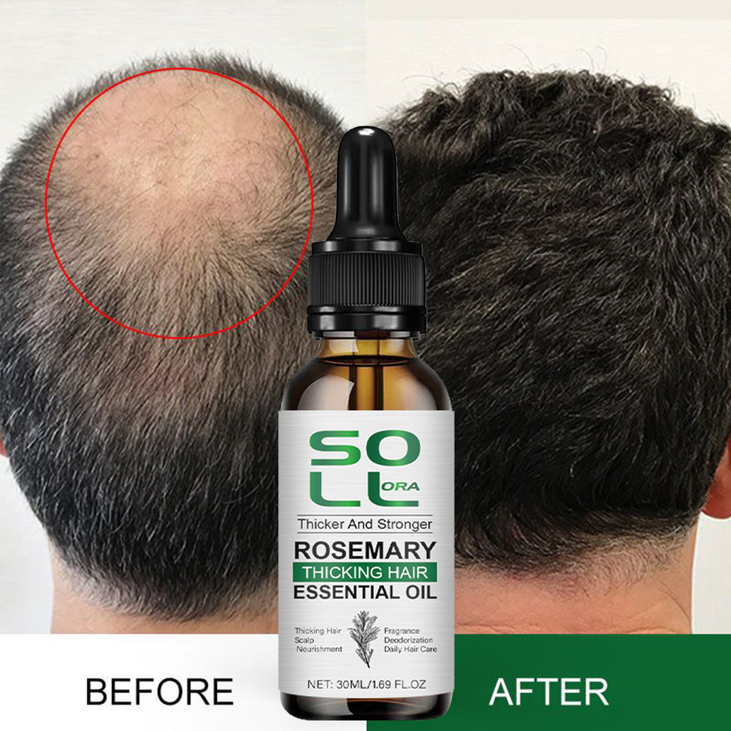 Hair End Rosemary Oil Essence Rosemary Hair Essential Oil SCHOLLORA Mens Hair Care Essential Oil% Y2