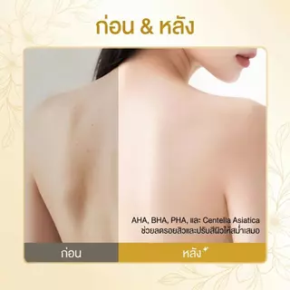 Grace and Glow English Pear and Freesia Acne Solution Body Wash ครีมอาบน้ำลดสิว 400ml