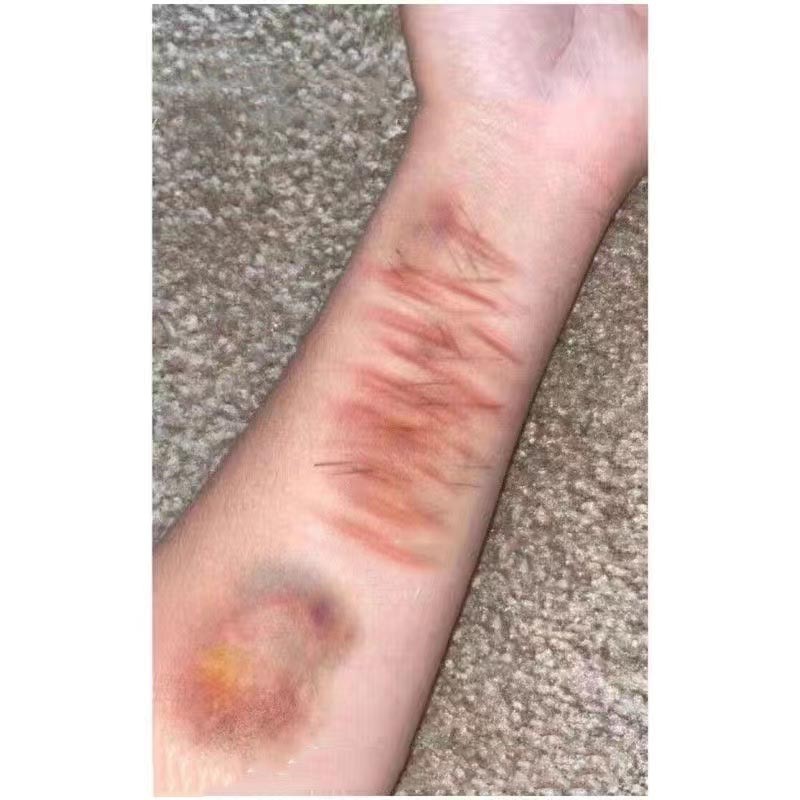 ♞Bruises Morbid Aesthetic Scar Tattoo สติก☀