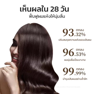 （ซื้อ 1 แถม 1）แชมพูน้ำมันมะพร้าว แชมพูสูตรอ่อนโยน ลดรังแค ควบคุมความมัน บำรุงรากผมให้แข็งแรง ผมนุ่มฟู500ml