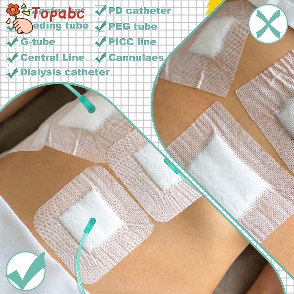 TOPABCLE 10pcs Chest Catheter Cover, Peritoneal Retrain Gtube Supplies Feeding Tube Pad, ทนทานอุปกรณ